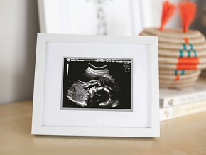Pearhead Ramka na Zdjęcie USG